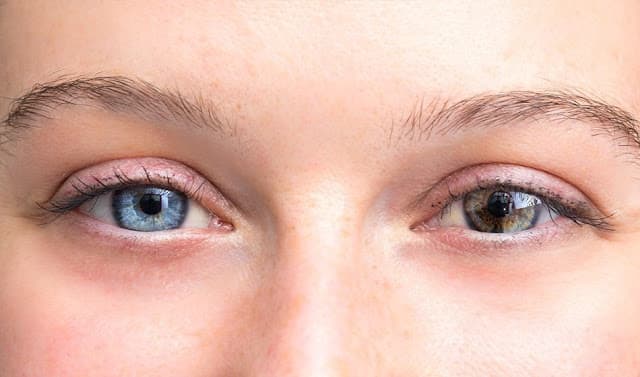 Entenda por que algumas pessoas têm olhos de cores diferentes
