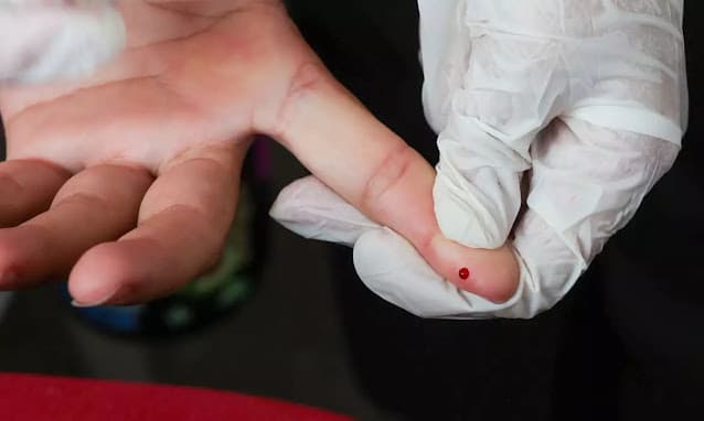 SUS passa a oferecer teste rápido de dengue