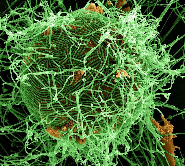 EUA anunciam doação de quase US$38 milhões a mais para resposta ao Ebola