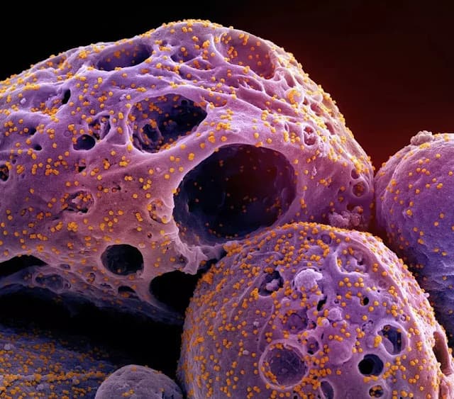 Covid: rede global de virologistas faz alerta sobre nova variante BA.3.2, com maior escape imunológico; entenda o risco